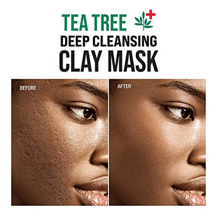 Kiss New York Face Moisturizer Tea Tree Oil Control-tt04(1 Pack, 4.23 Ounce)